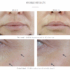 R-RETINOATE DAY & NIGHT - sérum aktivující mládí